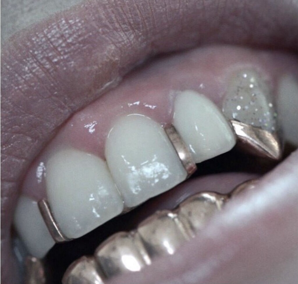 Grillz - © Artlist