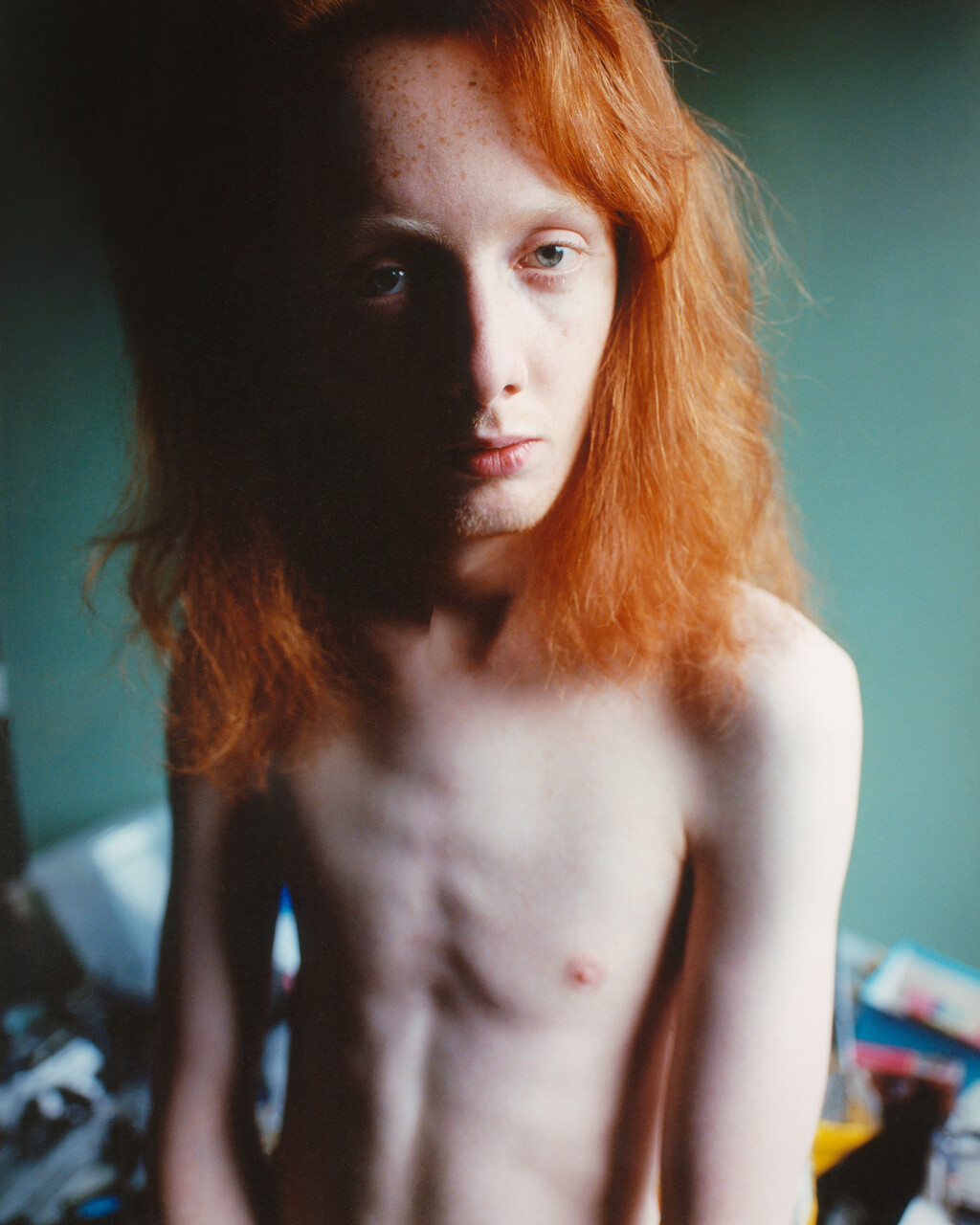 Birk - © Artlist